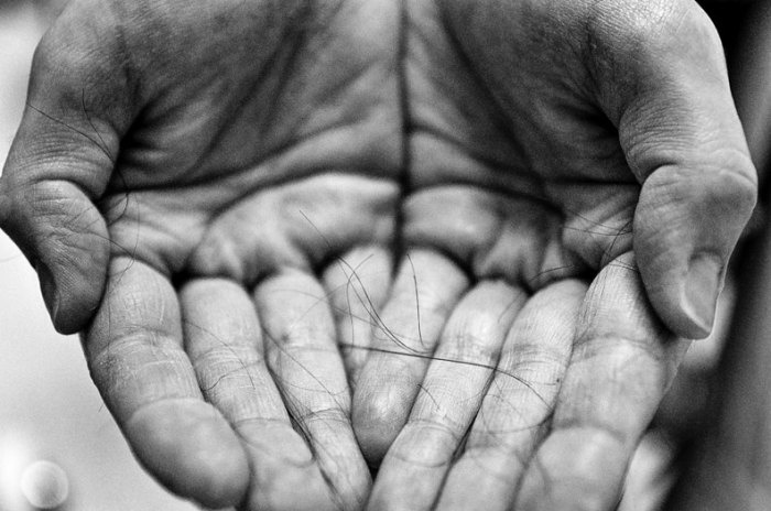 Συγκινητικό: Φωτογράφιζε τη γυναίκα του σε όλα τα στάδια του καρκίνου