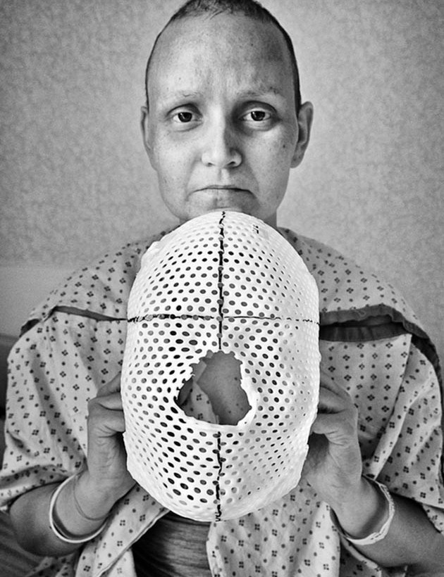 Συγκινητικό: Φωτογράφιζε τη γυναίκα του σε όλα τα στάδια του καρκίνου