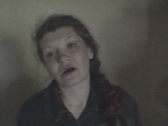 Τρομακτική αλλαγή νεαρής ναρκομανούς σε 6 χρόνια