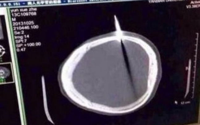 Έπαθαν ΣΟΚ: Περίμενε στην ουρά με ένα... μαχαίρι στο κεφάλι!