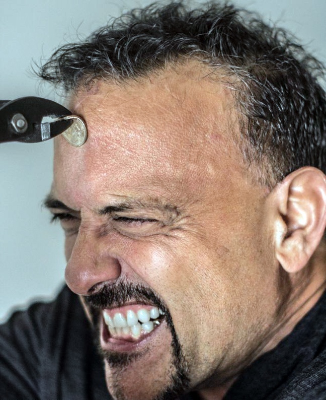 Το κεφάλι αυτού του άντρα είναι από ατσάλι (vid)