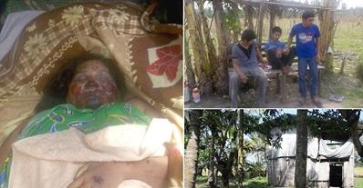 ΦΡΙΚΗ: Τρία αδέρφια έσφαξαν τη μητέρα τους και έφαγαν τα όργανά της