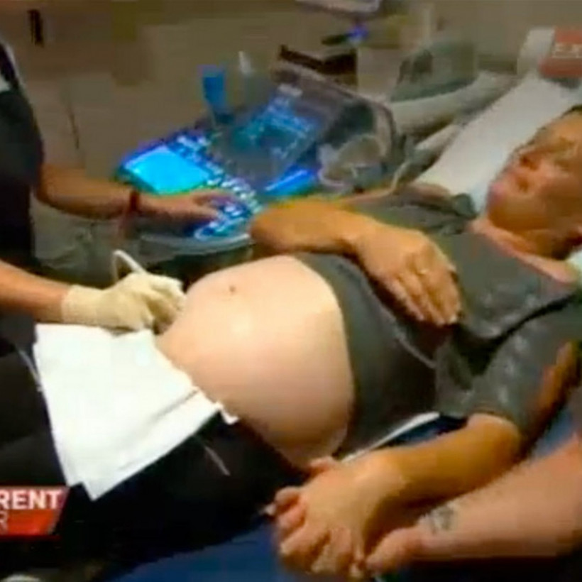 «Πάγωσε» όταν οι γιατροί της είπαν ότι κυοφορεί μωρό που έχει...