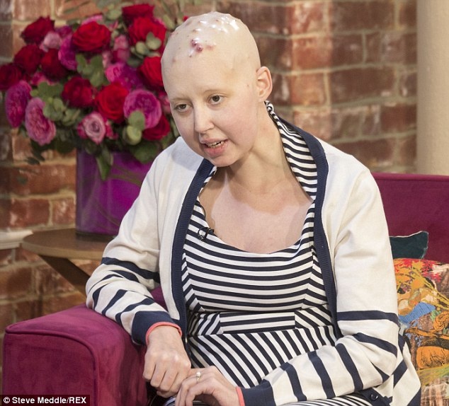 Έφυγε η 24χρονη-σύμβολο για τον καρκίνο στο πάγκρεας