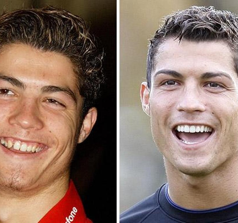 K. Ρονάλντο: Δεν θα πιστεύετε πόσο άσχημος ήταν πριν 12 χρόνια (pics)