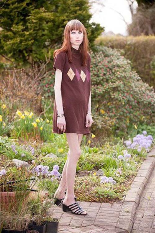 Ήθελε να μείνει για πάντα νέα και το μετάνοιωσε οικτρά (photos)