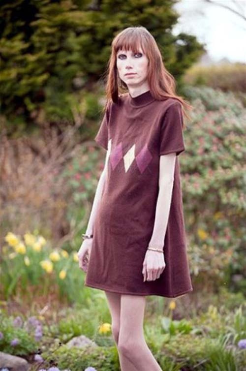 Ήθελε να μείνει για πάντα νέα και το μετάνοιωσε οικτρά (photos)