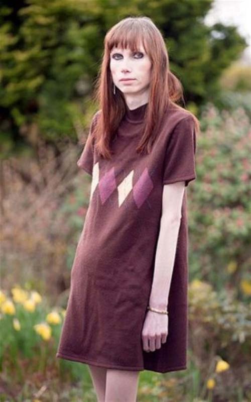 Ήθελε να μείνει για πάντα νέα και το μετάνοιωσε οικτρά (photos)