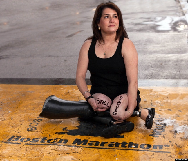 The survivors of Boston Marathon one year later (pics)