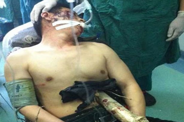 Αυτοί που ξεγέλασαν το… Χάρο (videos+photos)