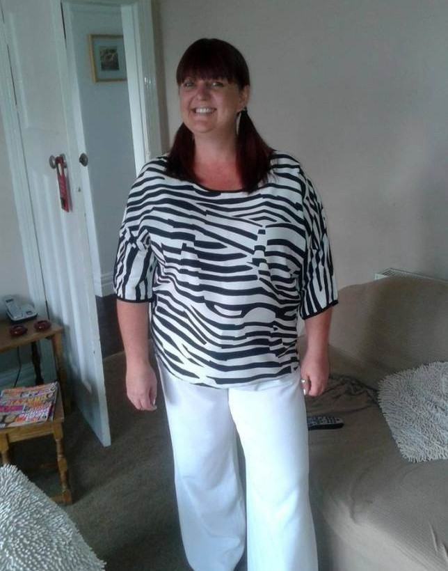 Τη δάγκωσε αράχνη για δεύτερη φορά! (προσοχή: σκληρές εικόνες)