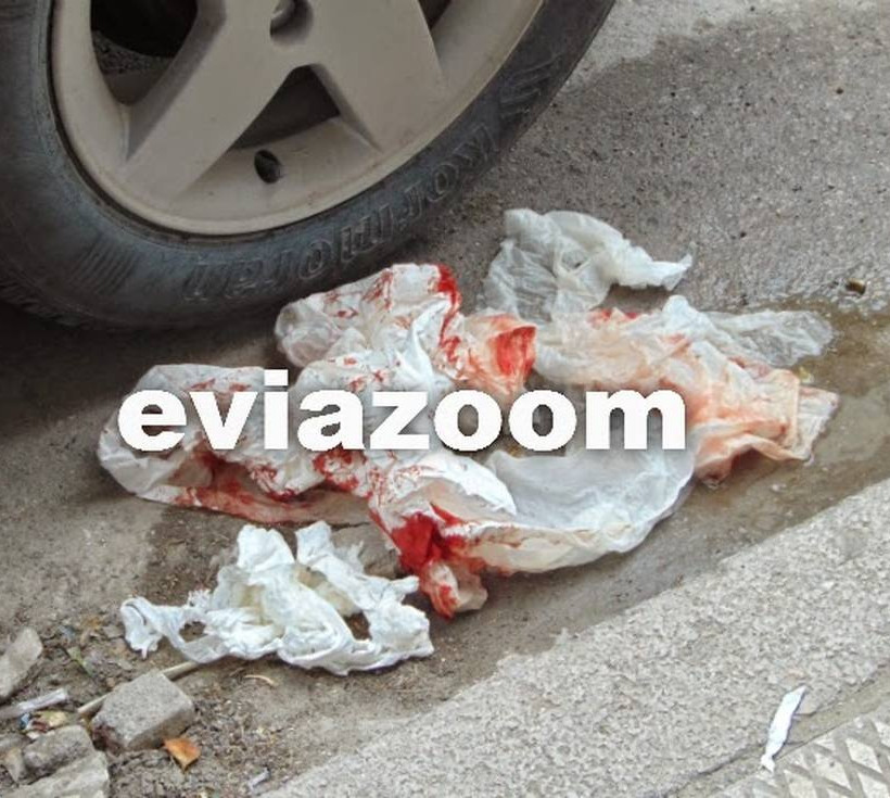 Φρικτό ατύχημα στη Χαλκίδα: Αστικό λεωφορείο έκοψε τα δάχτυλα νεαρής γυναίκας (vid)