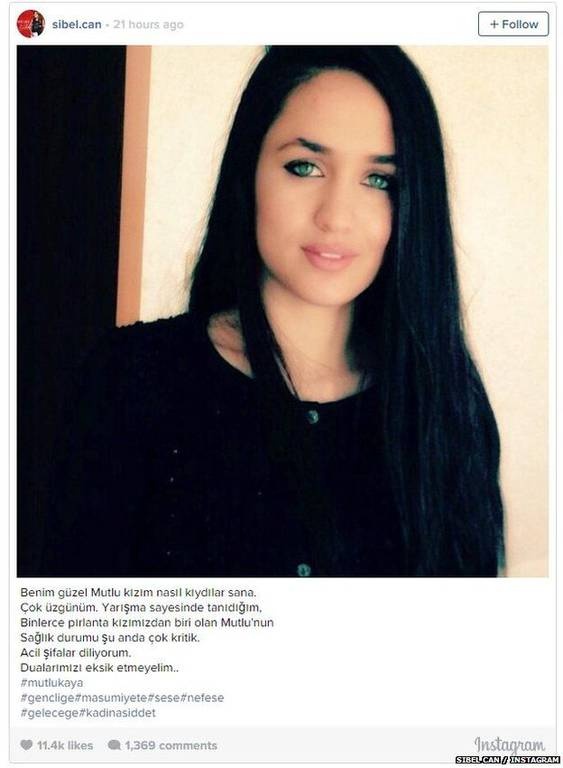 Πυροβόλησαν στο κεφάλι 19χρονη διαγωνιζόμενη σε δημοφιλές talent show