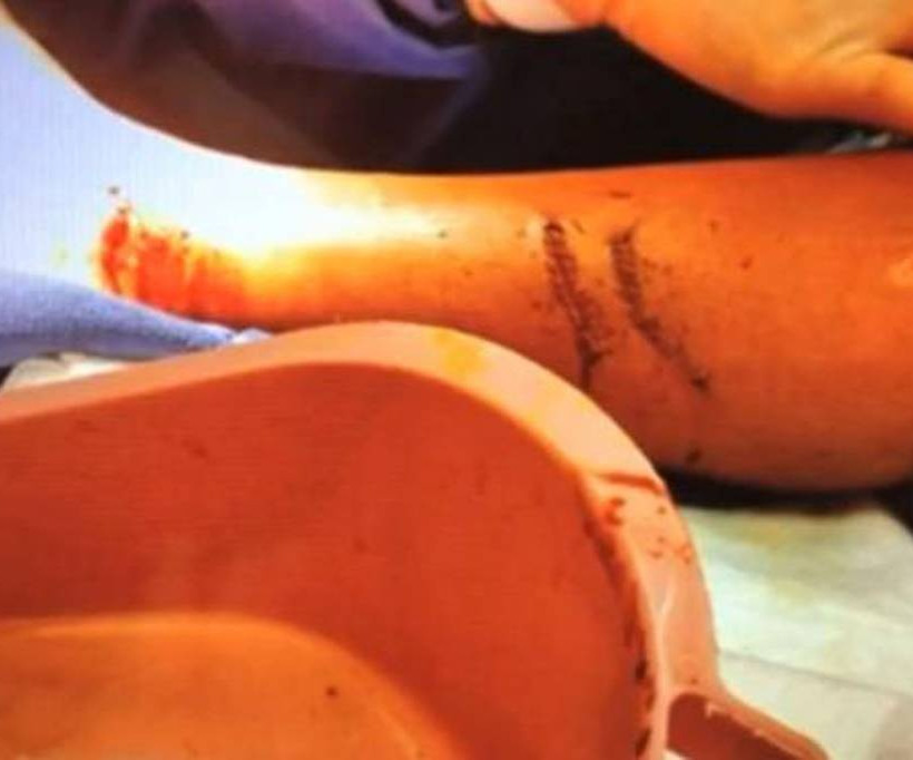 Δεκάχρονος πάλεψε με καρχαρία και τον έτρεψε σε φυγή! 