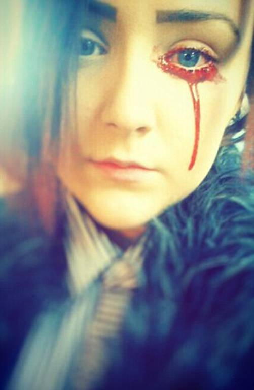 Το κορίτσι μυστήριο – Βγάζει αίμα από παντού στα καλά καθούμενα – Αντέχετε να το δείτε; (pics) 