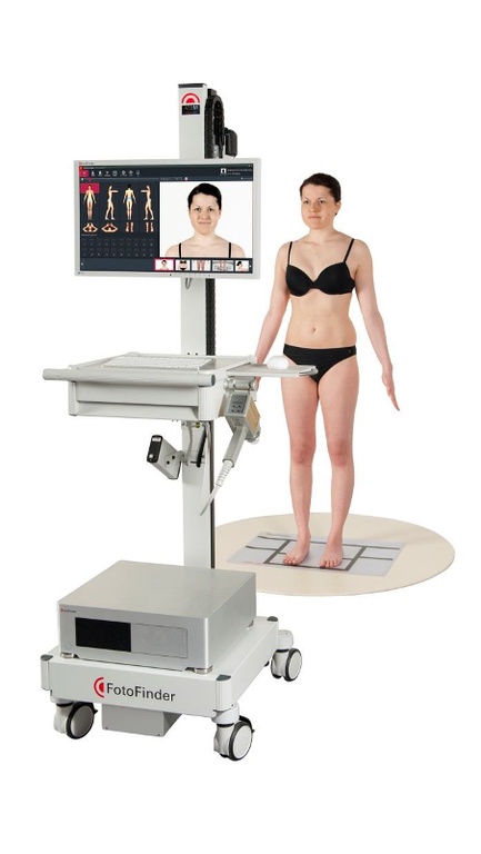 Σπίλοι(Ελιές): Προσοχή στην άσκοπη αφαίρεση