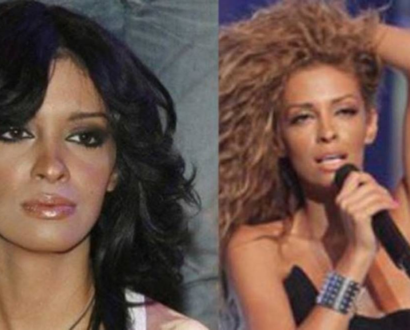 Θα τρίβεις τα μάτια σου! Εσύ έχεις δει τη Φουρέιρα πριν τις πλαστικές; (photos)