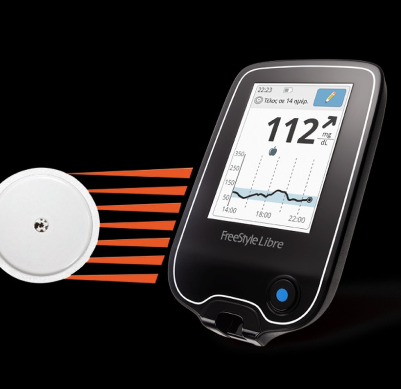 Επαναστατική Μέθοδος Παρακολούθησης της Γλυκόζης Χωρίς Τρυπήματα στα Δάκτυλα