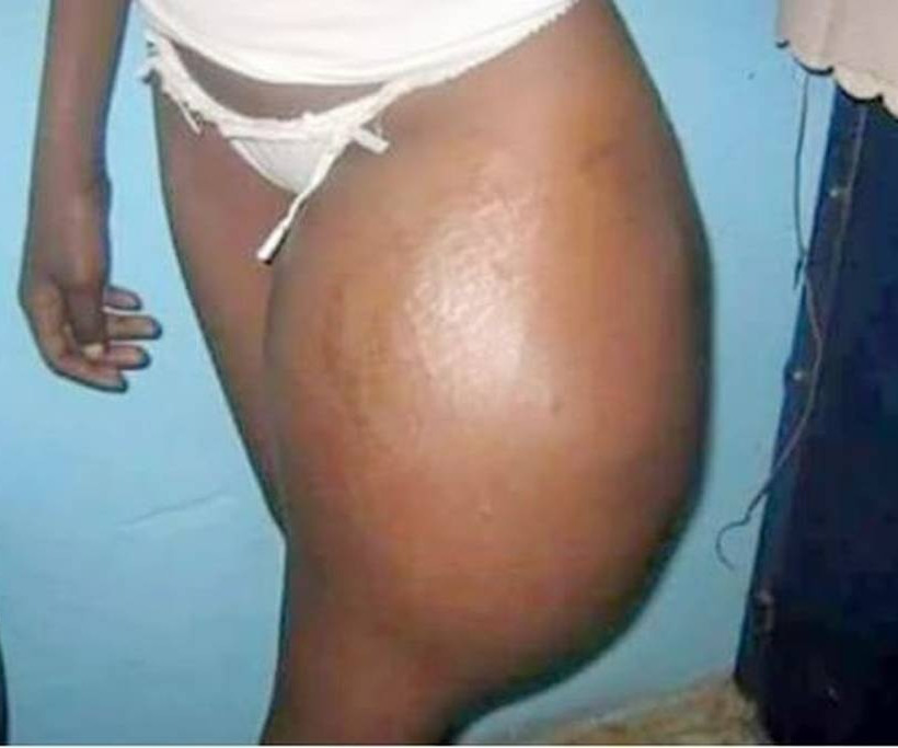 Σοκαριστικές εικόνες: Ήθελε τα οπίσθια της Καρντάσιαν και δείτε πώς έγινε