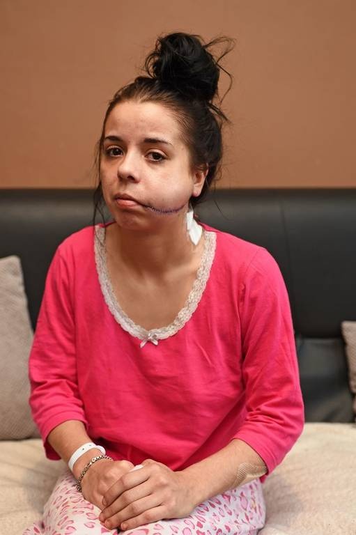 Φρίκη: Τον χώρισε και της χαράκωσε το πρόσωπο για «να μην την έχει ποτέ άλλος άνδρας» (pics)