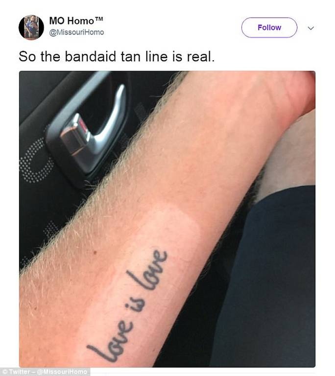 Να τι παθαίνεις όταν δεν βάζεις αντηλιακό στην παραλία (photos)