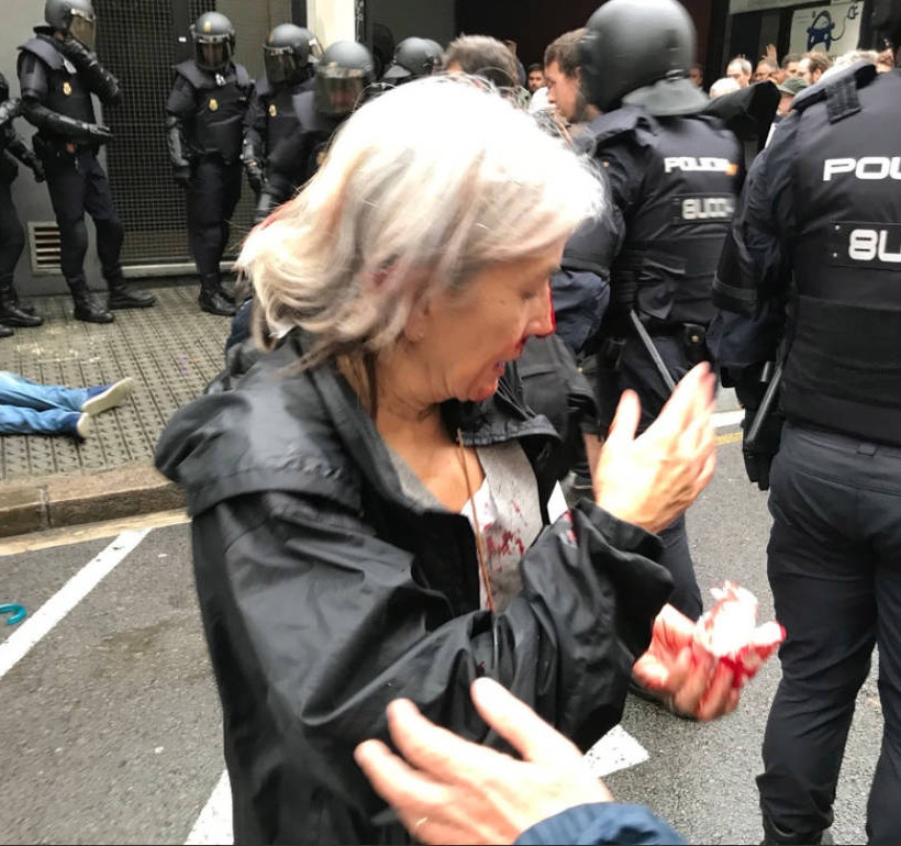 Καταλονία: Πνίγηκε στο αίμα το δημοψήφισμα – Πρωτόγνωρες σκηνές αστυνομικής βίας με 761 τραυματίες