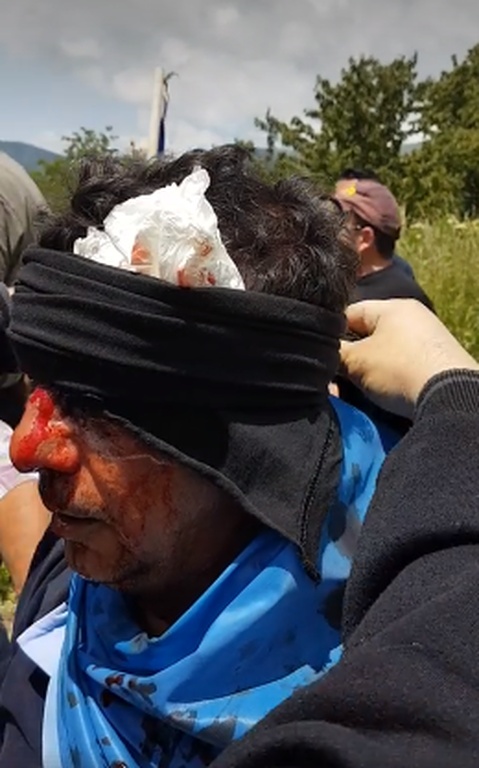 Μακεδονικό:  H «ματωμένη σημαία» που έγινε σύμβολο των διαδηλωτών στο Πισοδέρι Φλώρινας (vids+pics)