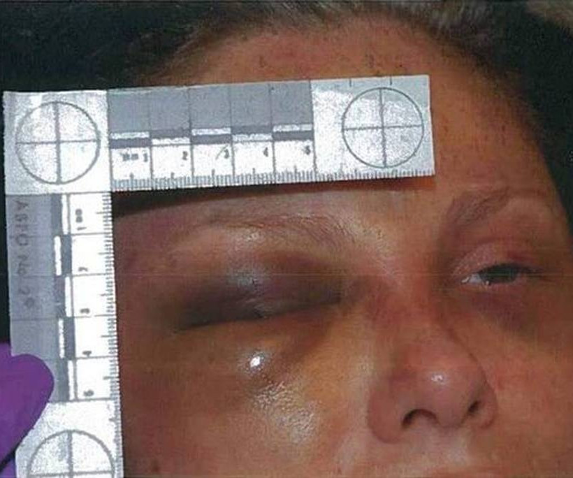 Μία από τις χειρότερες υποθέσεις κακοποίησης: Δεν φαντάζεστε τι ανάγκασε τη σύντροφό του να φάει