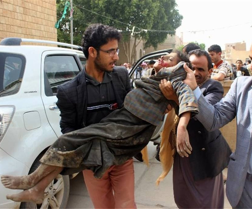 Μακελειό Υεμένη: Άμεση ανεξάρτητη έρευνα για τη σφαγή των παιδιών διέταξε ο ΟΗΕ (ΣΚΛΗΡΕΣ ΕΙΚΟΝΕΣ)