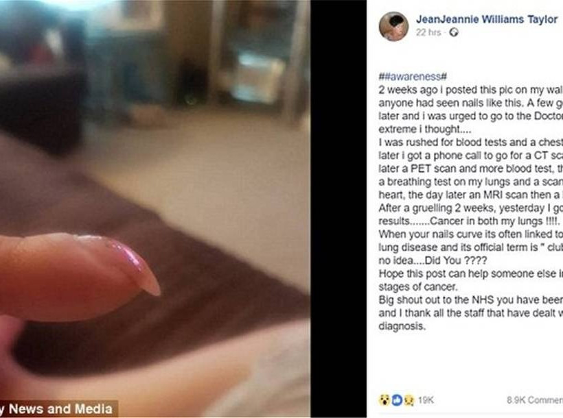 Απίστευτο: Τα «άσχημα» νύχια της «πρόδωσαν» τον εφιάλτη! (pics)