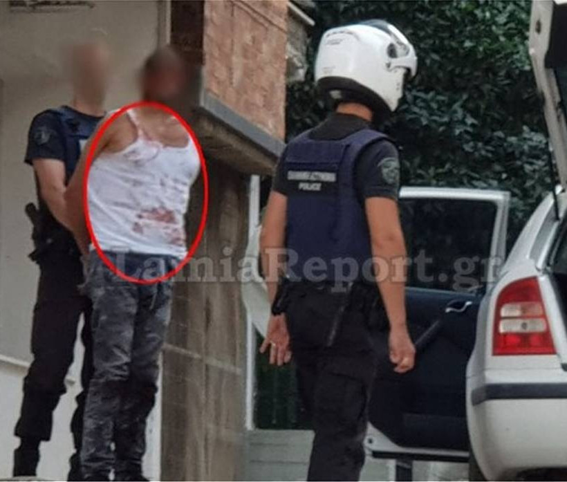 Λαμία: Μάχη για τη ζωή της δίνει η 25χρονη που μαχαιρώθηκε από τον αδελφό της φίλης της