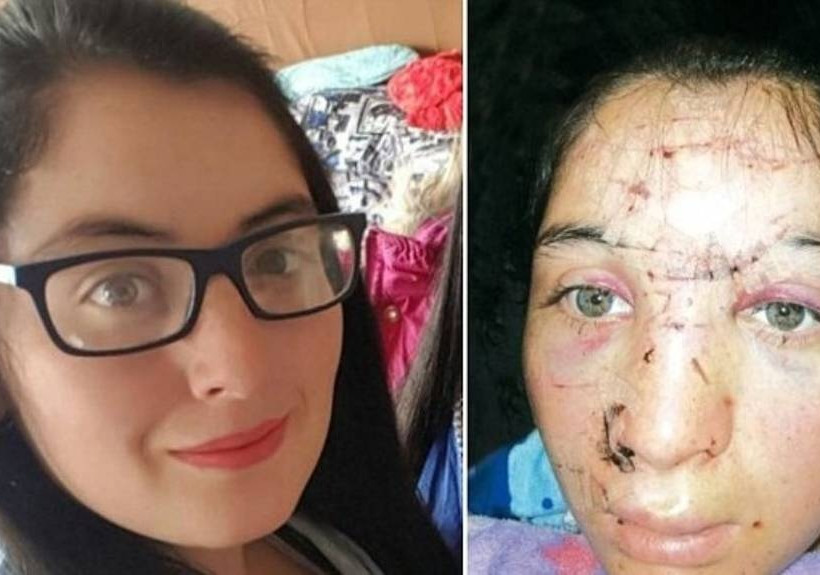 Φρίκη: Τη βίασε, μετά της έκανε πρόταση γάμου και επειδή αρνήθηκε, τη βασάνισε με συρματόπλεγμα!