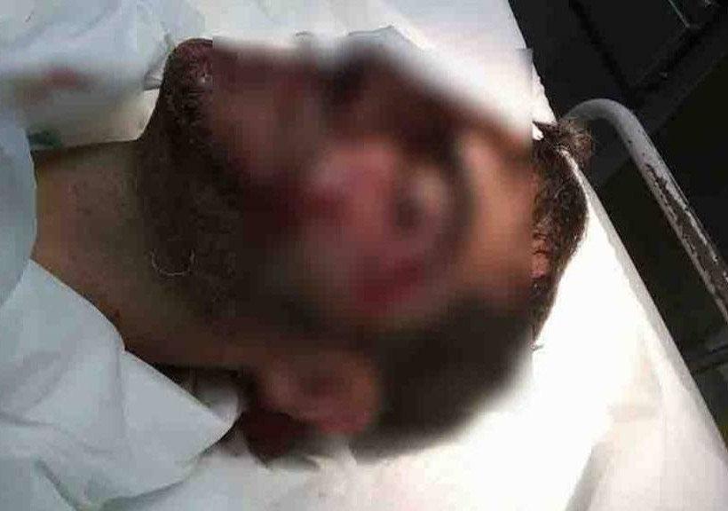 Ρόδος: 33χρονος κατήγγειλε ότι δέχθηκε επίθεση από σκύλο