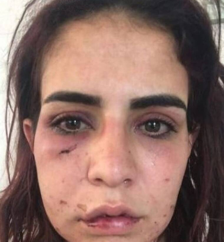 Η 24χρονη Beyza Yurttas 