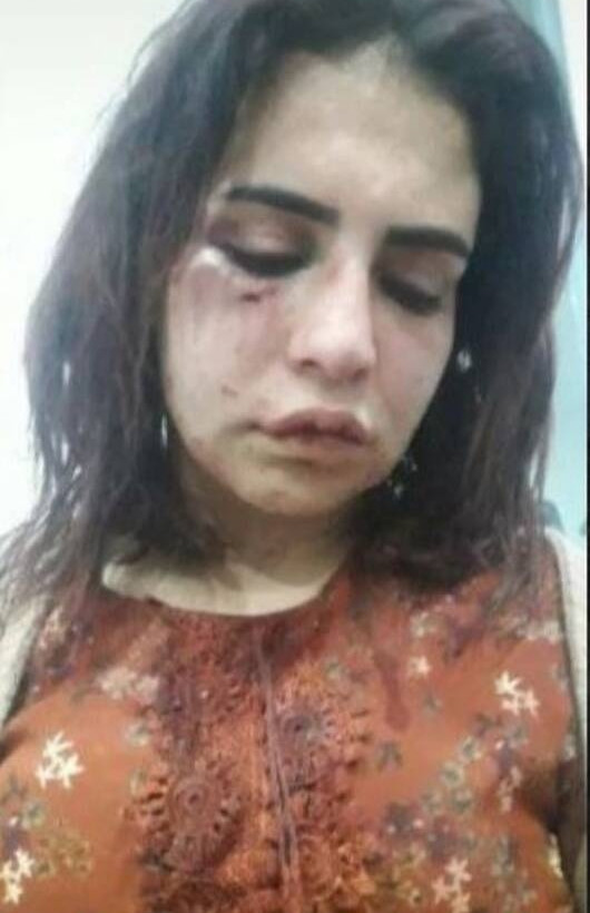 Η 24χρονη Beyza Yurttas 