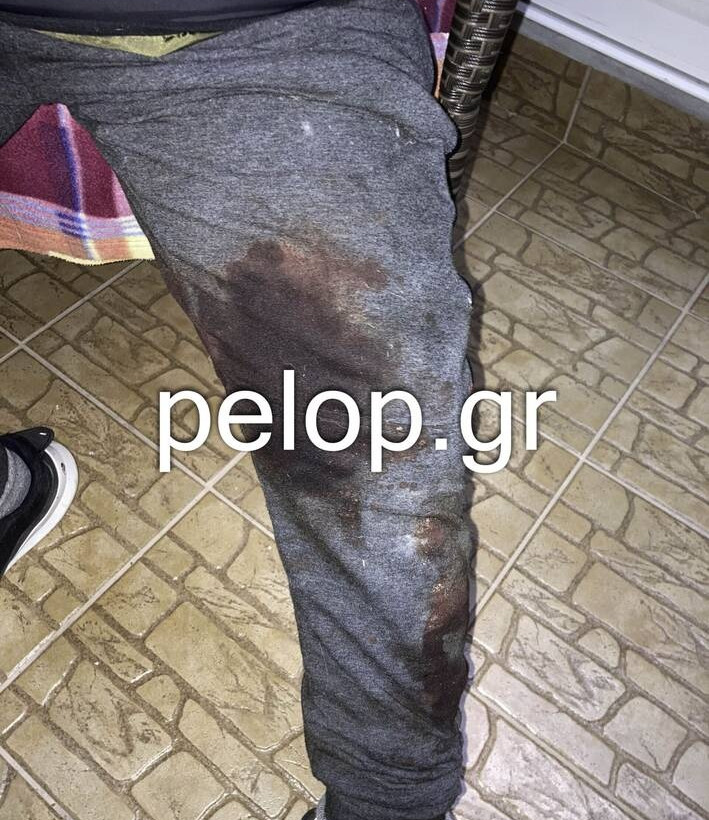 Τον τρόμο έζησε ένα ζευγάρι στην Πάτρα που είχε βγει βόλτα με το εγγονάκι του