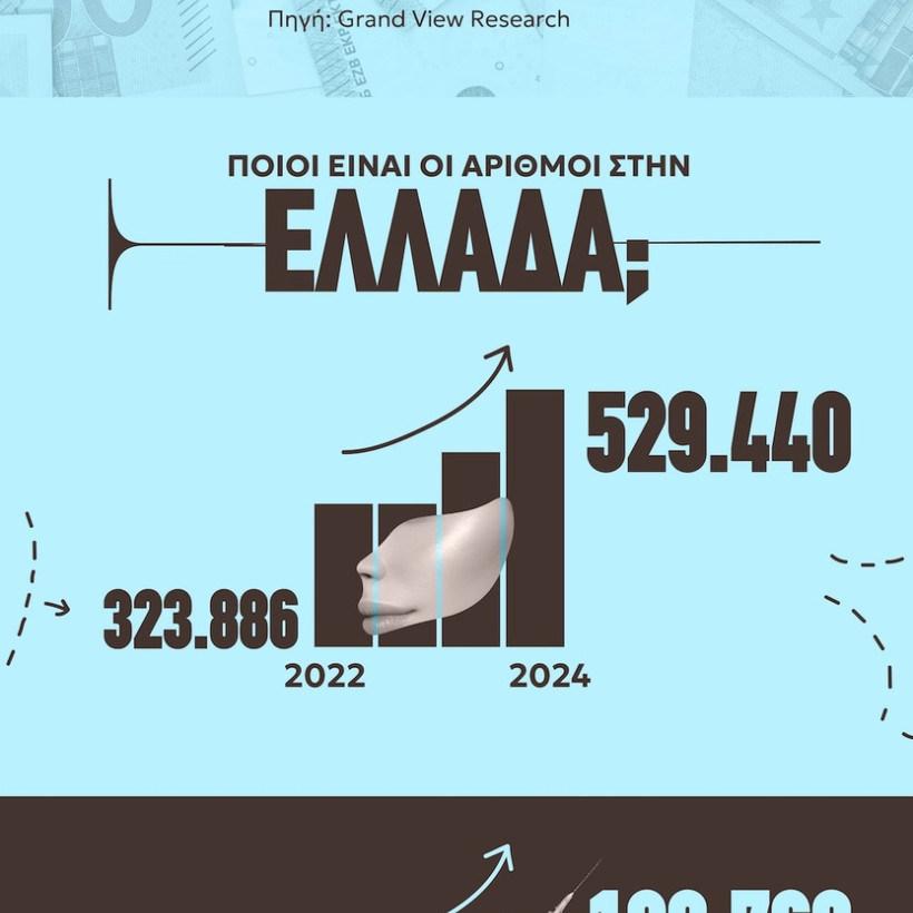 botox infographic