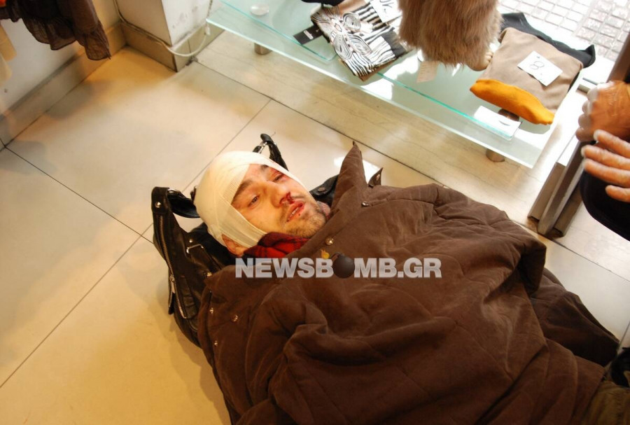 diadilothstravmatias