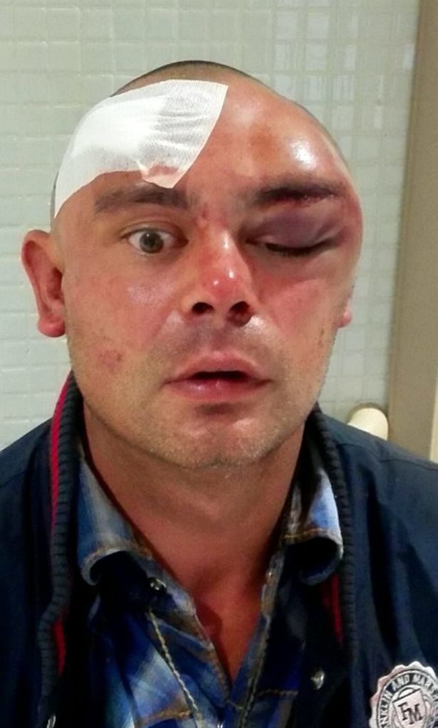 kanivalistiki epithesi