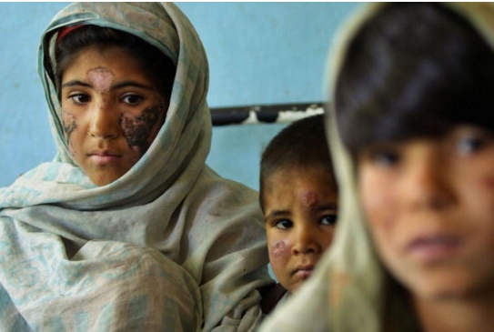 asthenia tzixantistes1