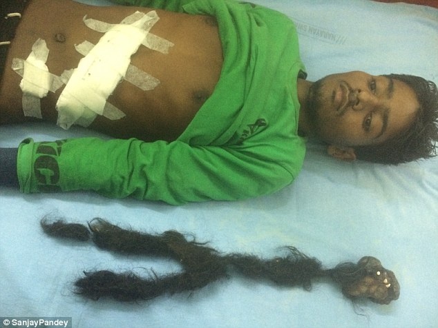 parasitikos didimos2