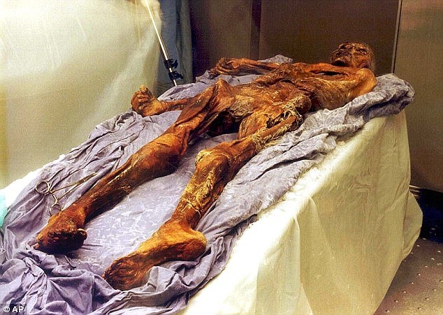 otzi2