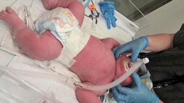 nintchdbpict000322761273