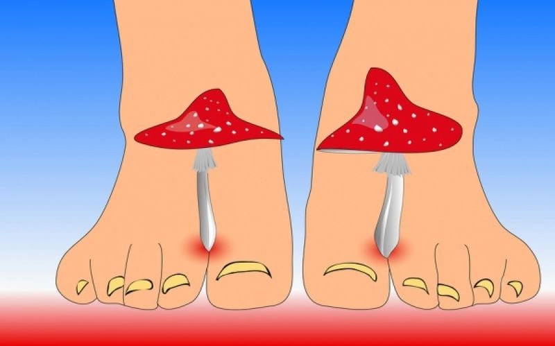 ce5f9cb5a3b17ee5fd2007d697f39a21 XL