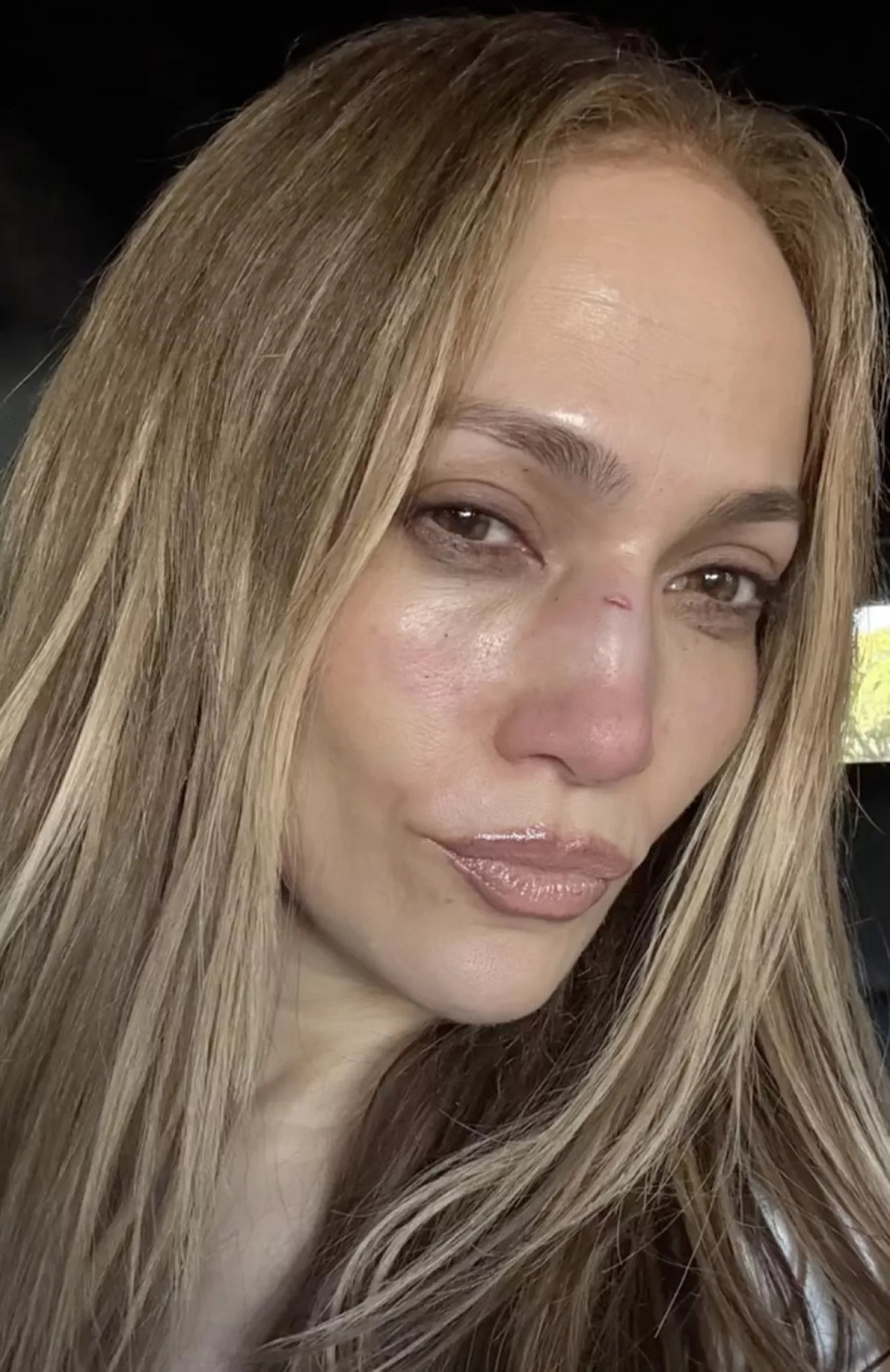 jennifer-lopez-traumatismos.jpg