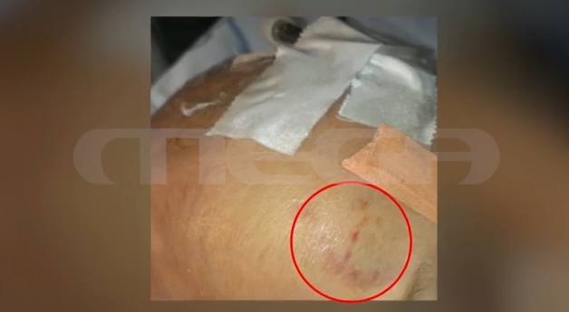 Tα σημάδια κακοποίησης του βρέφους