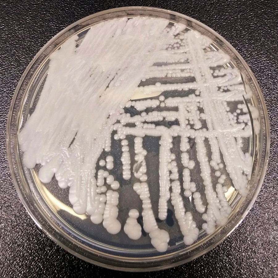 Μύκητας candida auris