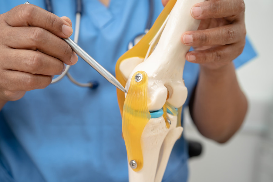 osteoarthritis-of-the-knee-doctor-holding-human.jpg
