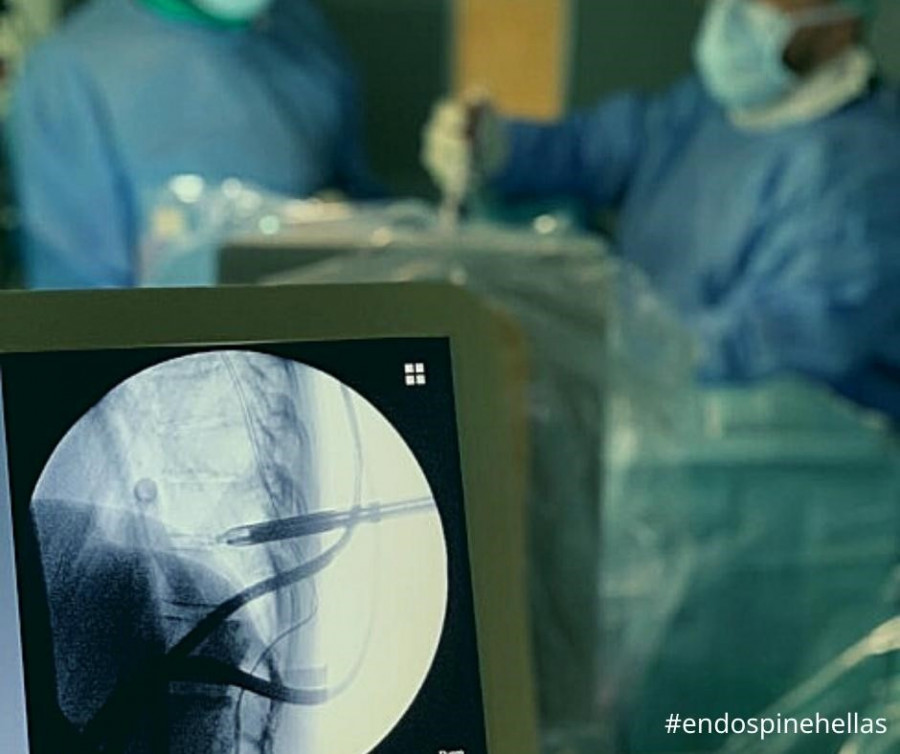 endospinehellas4.jpg