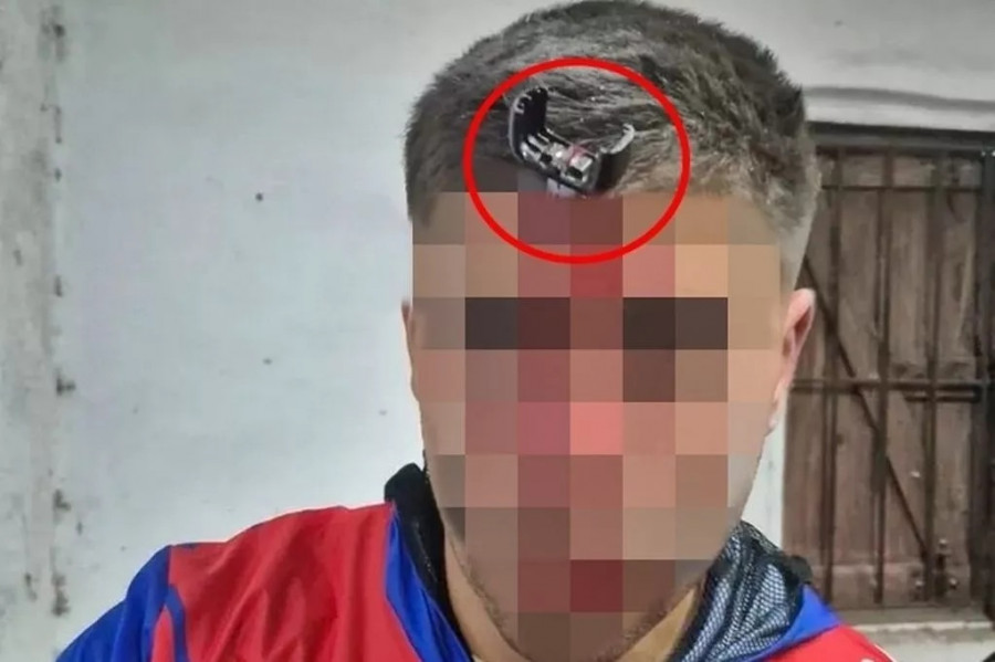 0car-key-embedded-in-footballers-forehead-after-violent-match-fight.jpg